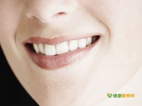 齒內漂白　還你一口完美笑容