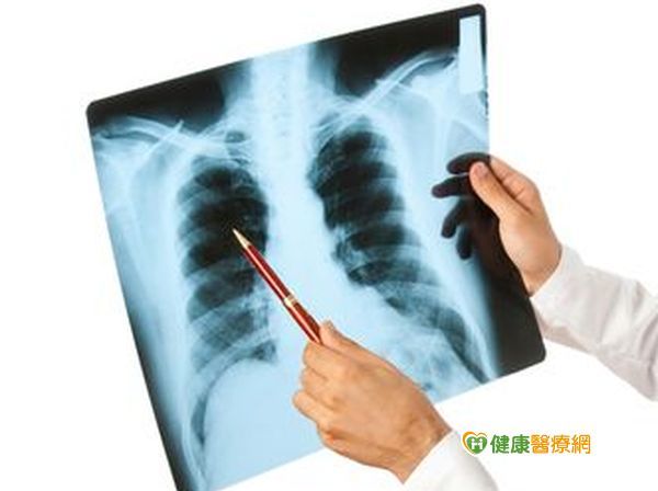 肺結核不專屬肺部　其他部位恐也會感染