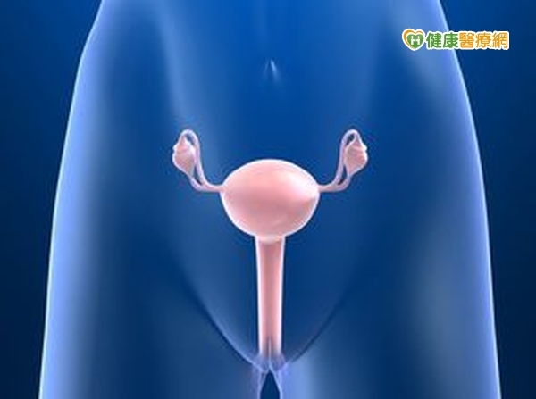 卵巢癌篩檢不普遍　逾半患者已末期