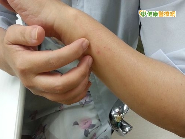 季節轉換　異位性皮膚炎易誘發