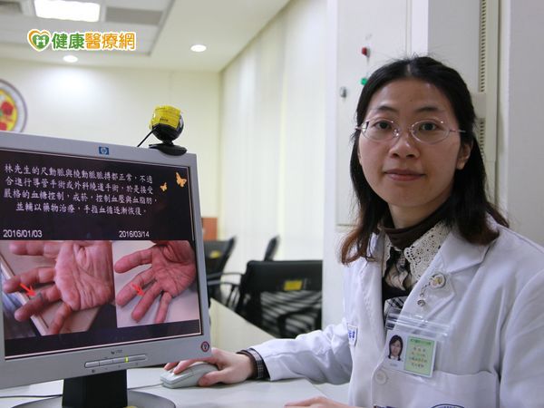 手指劇痛險截肢　竟是周邊動脈阻塞引起