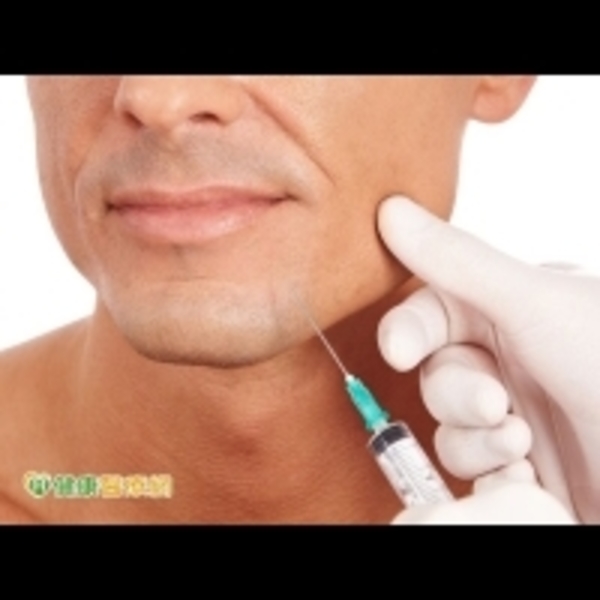 新春微整夯　男性也熱衷哪些項目？