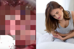 女性注意!!!!下腹痛「不可忽視」可能是「子宮腺肌症」警訊，應儘早就醫！！！！