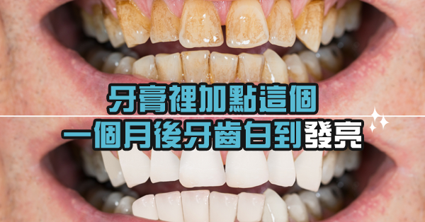 滿口黃牙讓你不敢露嘴笑？牙膏裡加點這個，一個月後牙齒白到發亮！