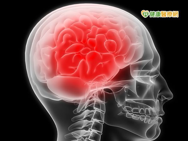 一氧化碳中毒5步驟　避免缺氧造成腦死