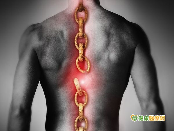 壓迫性骨折　椎體成型骨水泥灌注術有效急救