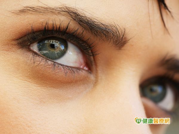 眼睛有異物感　恐是眼結石惹禍