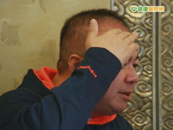 五成女不愛禿頭男　藝人小董髮際線危機飆