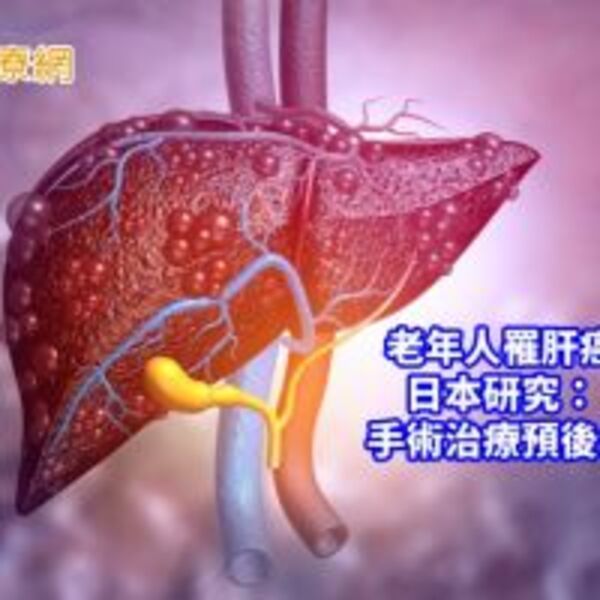 長者罹肝癌憂手術無法負荷？　醫：手術預後較佳