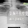 醫師最得力助手！　「AI」輔助判讀X光快速且精準