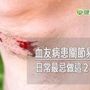 血友病患關節易出血！　日常最忌做這２件事