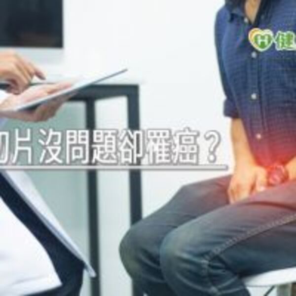 攝護腺切片沒問題卻罹癌？　新型切片法精準找到病灶