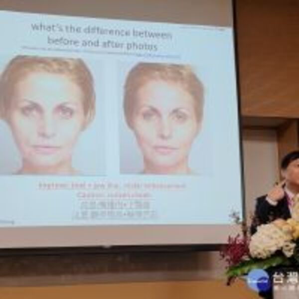 王正坤醫師主持台灣皮膚科醫學會研討會　發表國際醫學論文