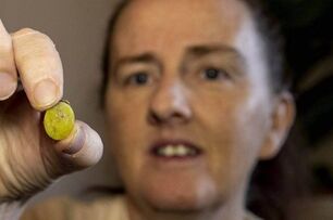 快篩完鼻子劇痛！紐西蘭女子赴院急診，挖出卡鼻腔內「37年的塑料片」
