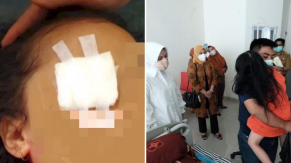 駭人聽聞！印尼一6歲女兒被家人徒手摳出眼球，警方：這家人信奉「黑魔法」，相信食人的力量