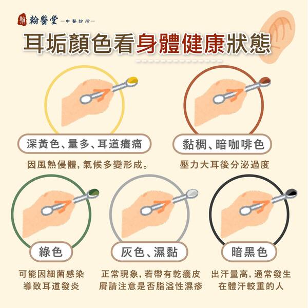 耳垢顏色原來有玄機！ 中醫師透露：「暗黑色的耳屎」是因為壓力太大