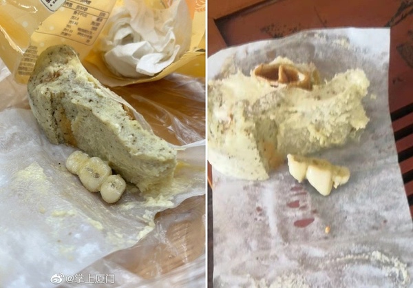 瑞士捲咬一口牙碎爆血！蛋糕掉出3顆「過期假牙」噁爆