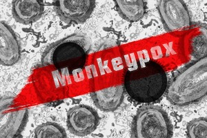 猴痘疫情累積全球超200例！羅氏藥廠宣布「已研發快篩試劑」