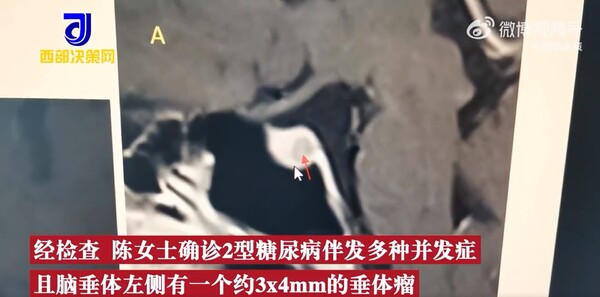 新聞圖片