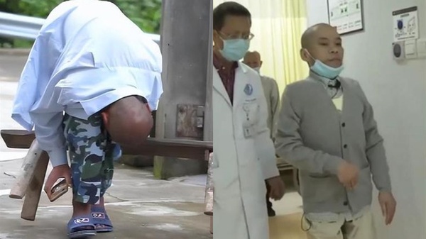 11歲罹罕病「折疊人」！他臉貼膝蓋煎熬30年　5次斷骨手術重生