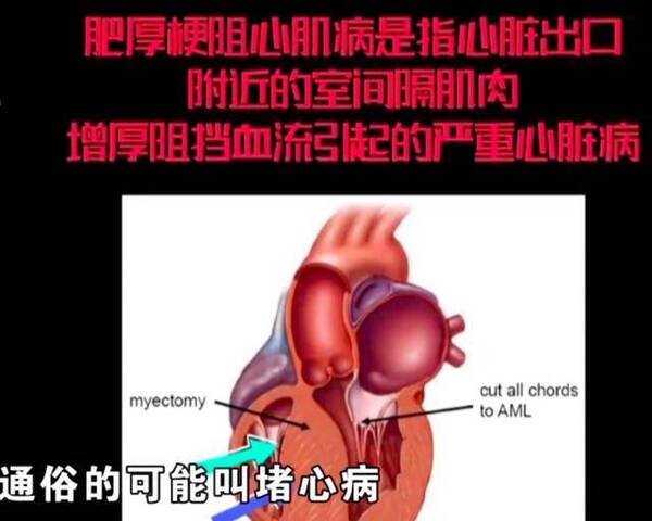 新聞圖片