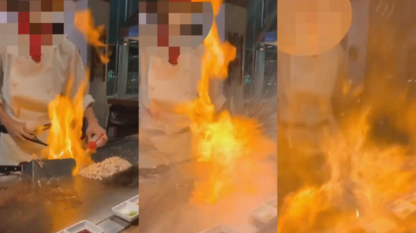 慎入！鐵板燒師傅「噴火秀」出事了　5歲童半臉慘被燒脫皮
