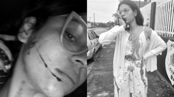 搭巴士醒來竟全身血！22歲女網紅「從嘴到耳遭割開」　驚悚監控曝