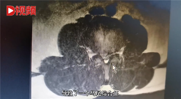 新聞圖片