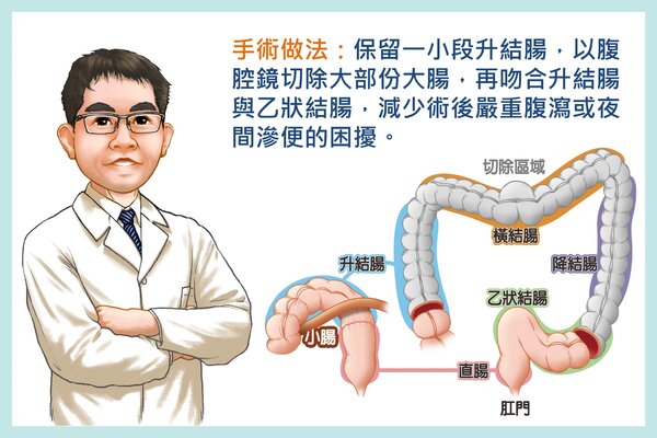 新聞圖片