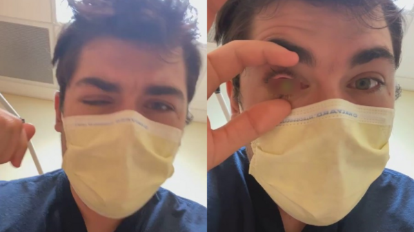 佛州21歲男大生戴隱眼小睡結果感染食肉細菌