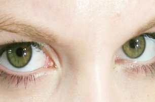 嚇！眼睛瞳孔自然由黑變綠　竟是.....要注意