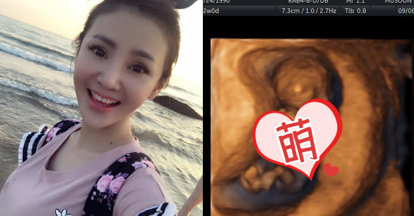 恭喜！《世間情》失控姐「陳子玄」結婚啦！雙喜臨門大曬「三個月胎照」！老公竟然是「他」...背景超厲害！