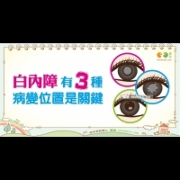 白內障的種類｜全民愛健康 白內障篇10