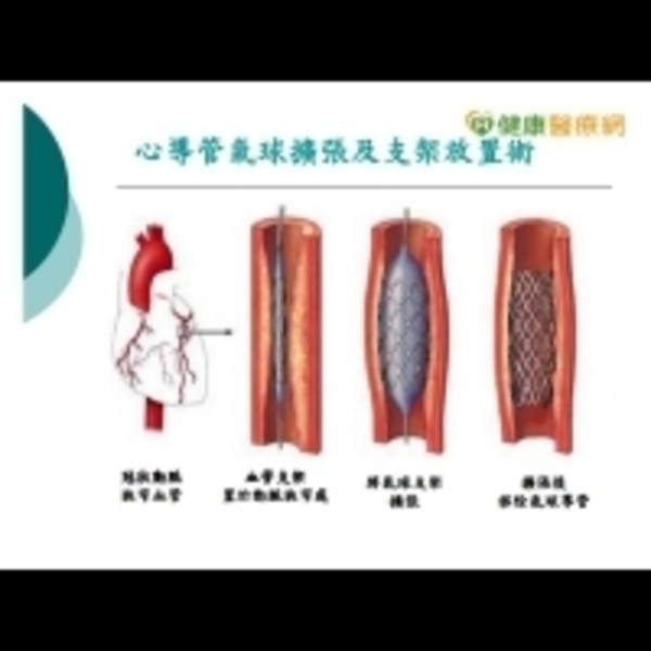 治血栓用吸的？　醫：網路謠言勿輕信