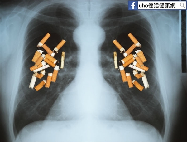 別再抽了！4成癮君子致COPD