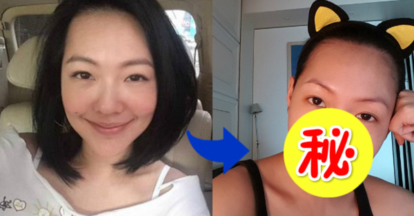 小S整形！自爆「鼻子動手術」！開心直呼「變正了！」…千方百計拯救「塌鼻」…竟是由於「這件事」讓她決心動刀！令人傻眼！