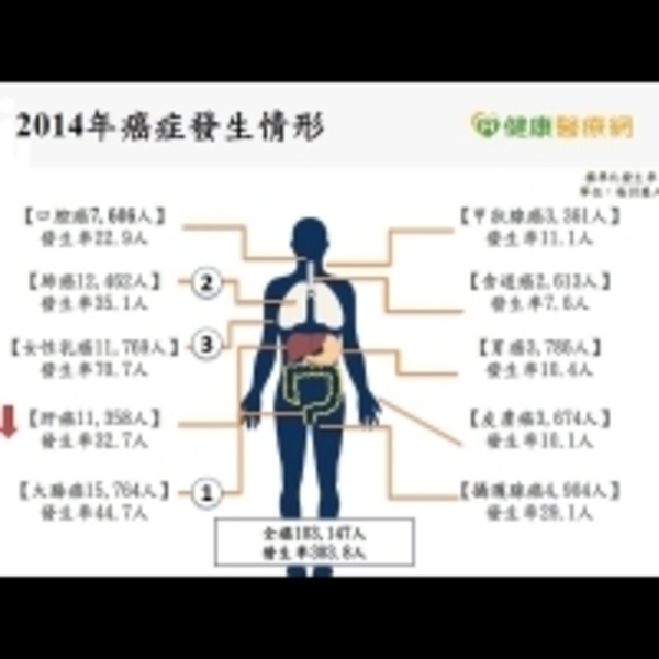 每5分6秒有1人罹癌　大腸癌連9年居首