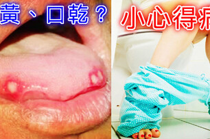 醫生警告：口乾舌燥、尿液偏黃還覺得沒事？小心是「這個疾病！」，應儘速就醫!!!!!