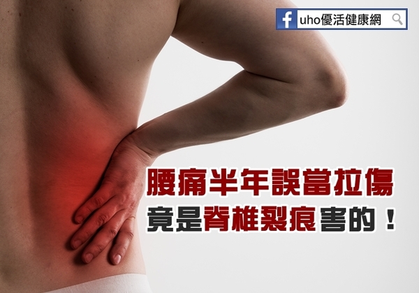 腰痛半年誤當拉傷　竟是脊椎裂痕害的！