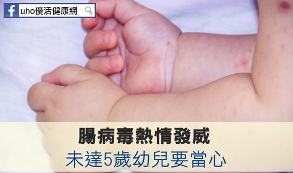 腸病毒熱情發威　未達5歲幼兒要當心