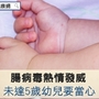 腸病毒熱情發威　未達5歲幼兒要當心