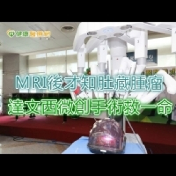 MRI後才知肚藏腫瘤　達文西微創手術救一命