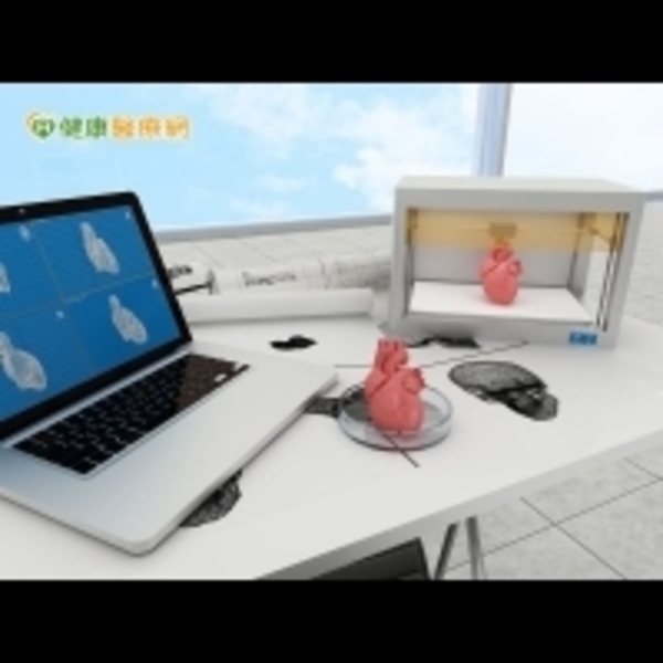 3D列印技術　降低心瓣膜手術風險