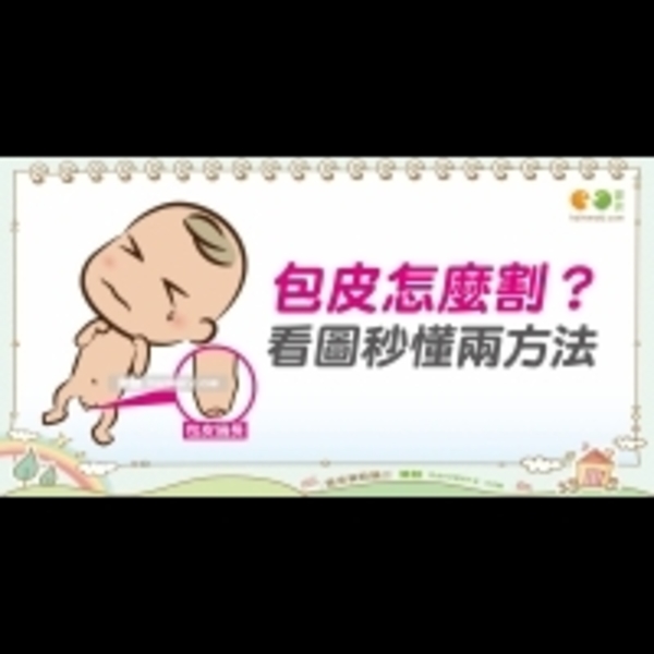 包皮怎麼割？｜Baby's talk 割包皮篇3