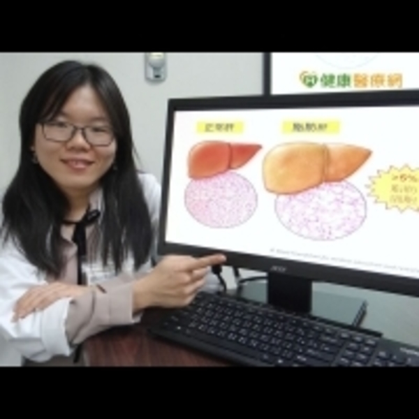 他1年胖10公斤　竟造成脂肪性肝炎上身