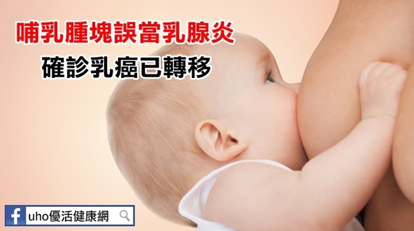 哺乳腫塊誤當乳腺炎　確診乳癌已轉移