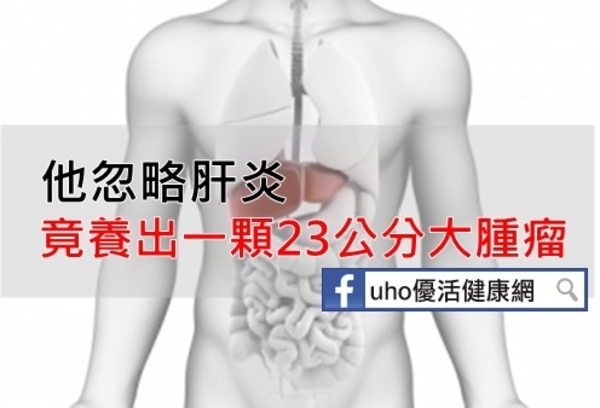 天啊！他忽略肝炎竟養出一顆23公分大腫瘤