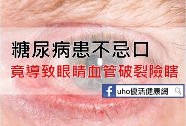 糖尿病患不忌口　眼睛血管破裂險瞎