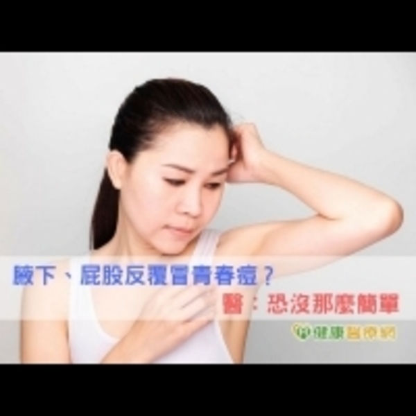 腋下、屁股反覆冒青春痘？　醫：恐沒那麼簡單