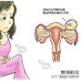 女性下腹痛的隱藏炸彈　比經痛可怕的異位懷孕